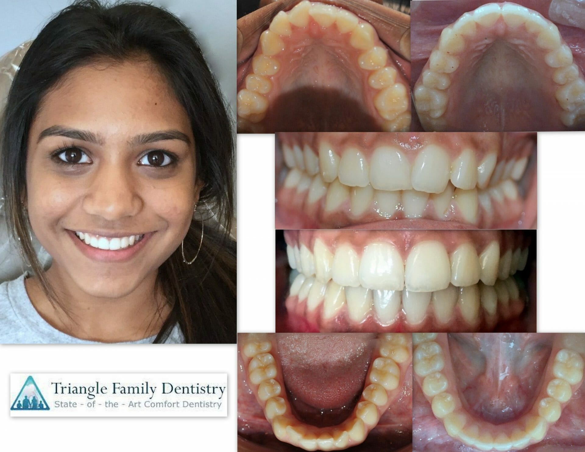 cosmetic-dentistry-wake-forest-nc-dentist