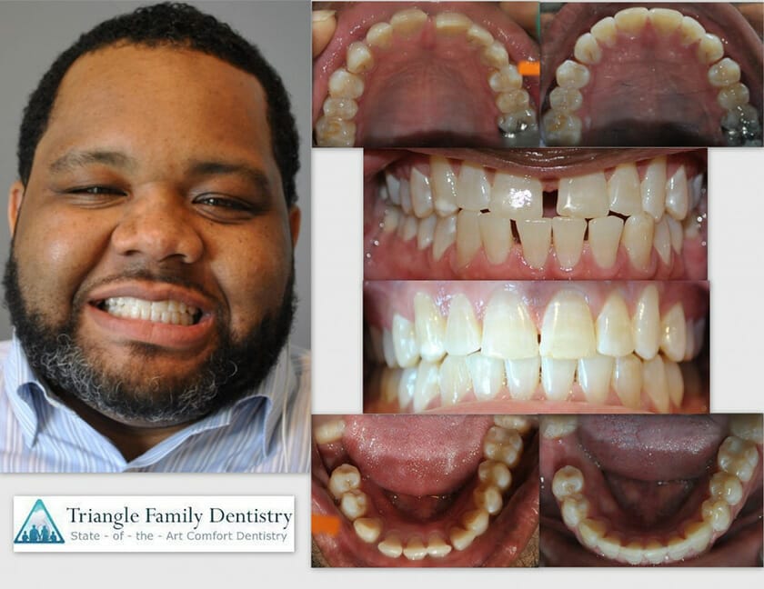 triangle-family-dentistry-Gregory-Kearnan-1140x880