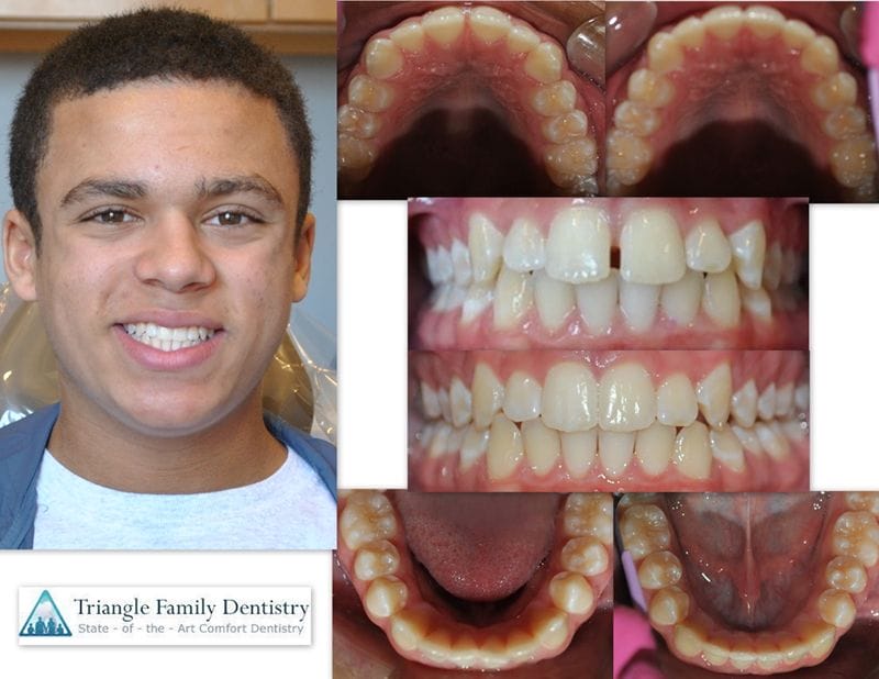 wake-forest-cosmetic-dentistry-family-dental-office1