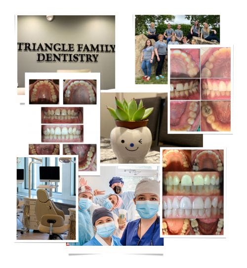 Dental Care for the Whole Family - Triangle Family Dentistry